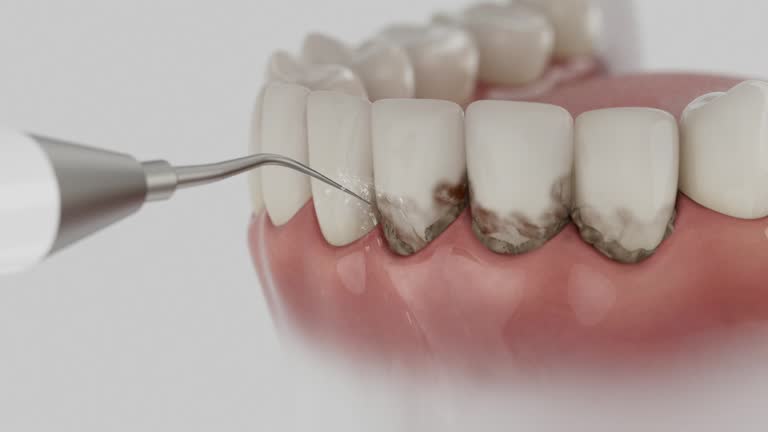 Trusted Dental Implants service in St. Simons, GA - Dentist Open Now
